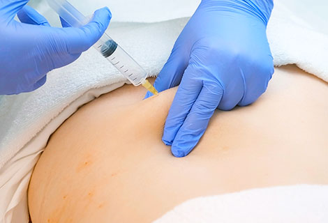 ozone Therapy Colville